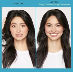 Living Proof Scalp Care Dry Scalp Treatment 100ml 5 Living Proof Scalp Care Dry Scalp Treatment 100ml -Goldwell Verkoop scalp care dry scalp sfeerfoto 2