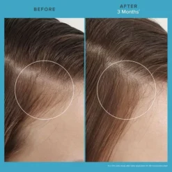 Living Proof Scalp Care Revitalizing Treatment 73ml -Goldwell Verkoop scalp care revitalizing treatment 5